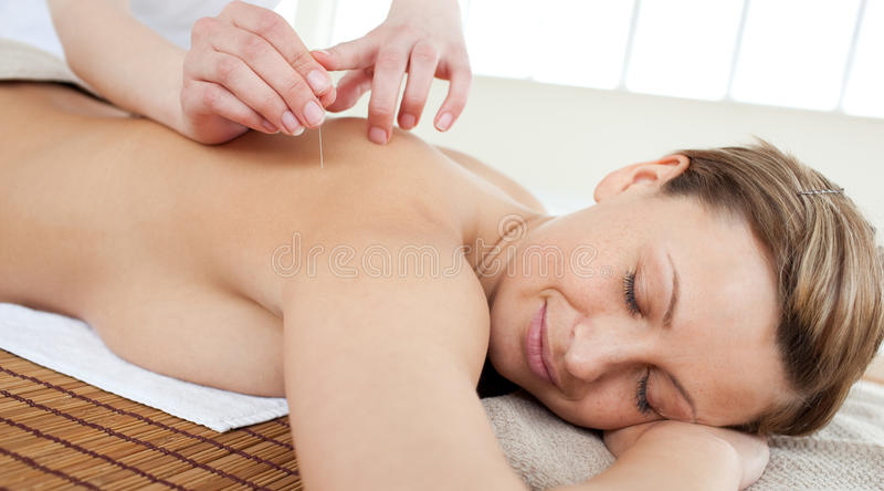 Acupuncture for Fibromyalgia