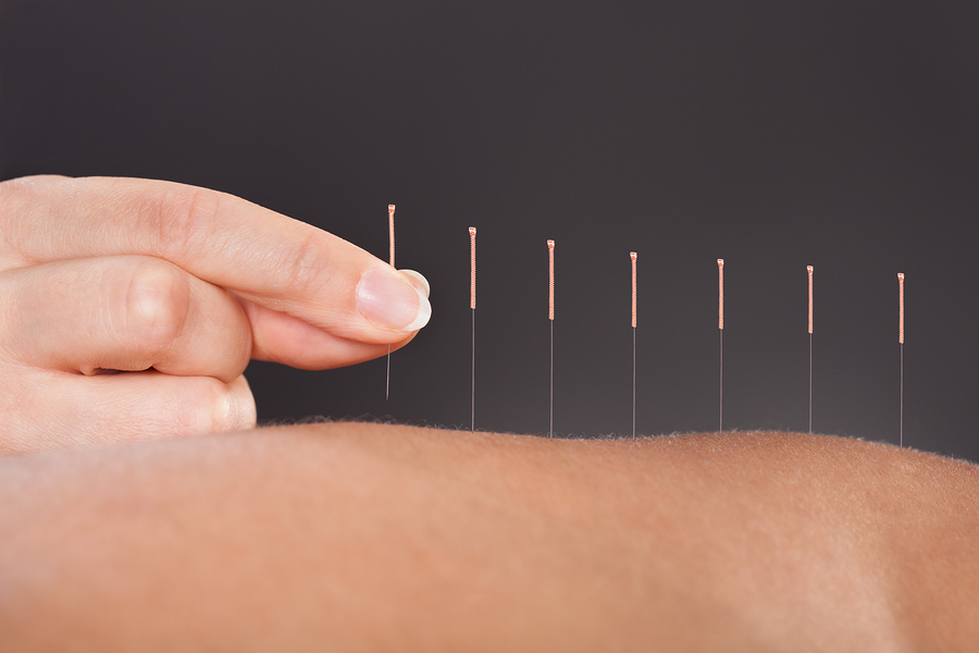 Acupuncture side effects