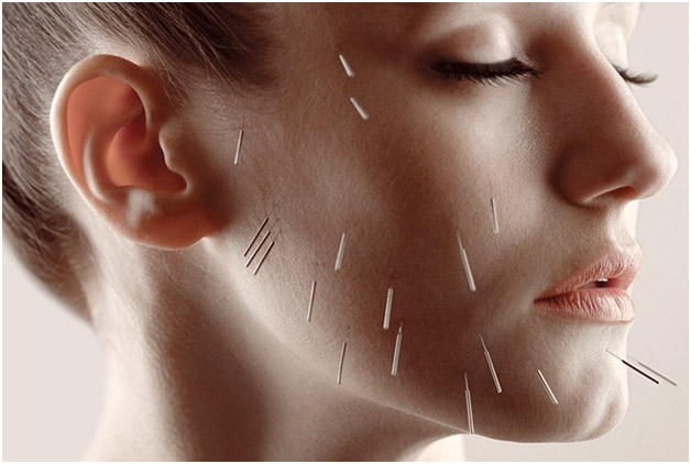 Acupuncture for Anxiety / Depression